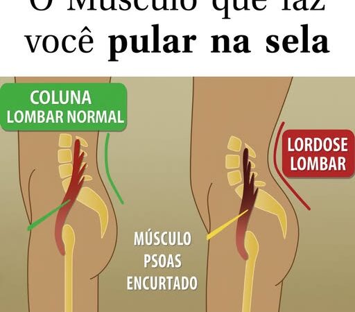 O iliopsoas é um dos músculos mais importantes para quem monta a cavalo.