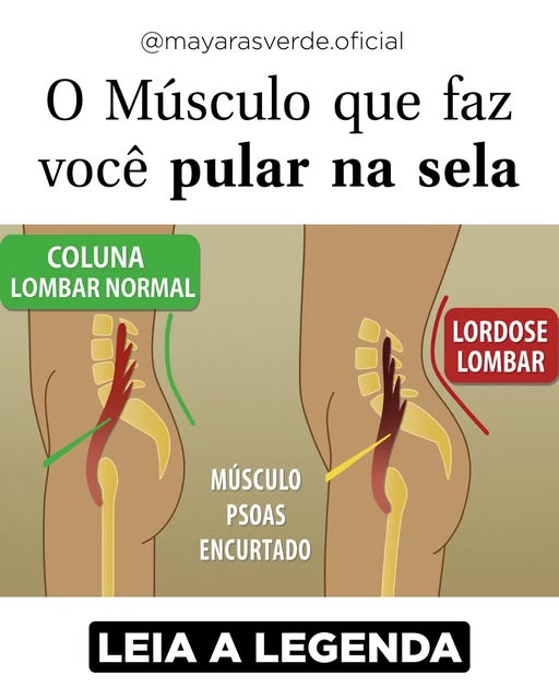 O iliopsoas é um dos músculos mais importantes para quem monta a cavalo.